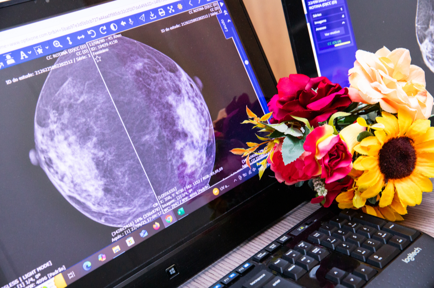 Melhor que prevenir, é prevenir!